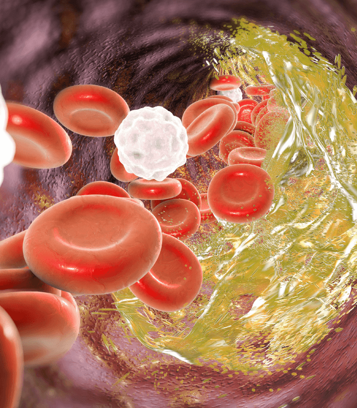 Arteriopatía coronaria, cardiólogo en mochis